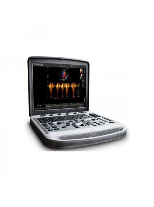 Chison Sonobook8 portátil con sonda lineal L12B-V (4-15 MHz)