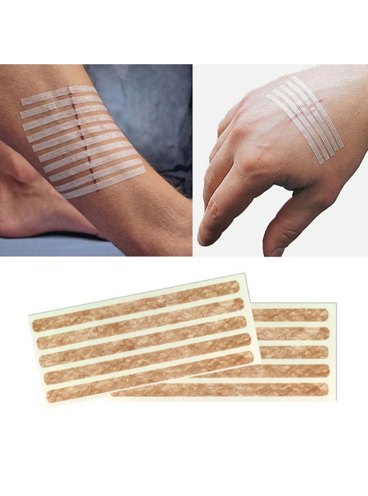 Puntos de aproximación Skin-fixe Strip